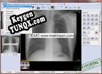 Махаон PACS генератор серийного номера